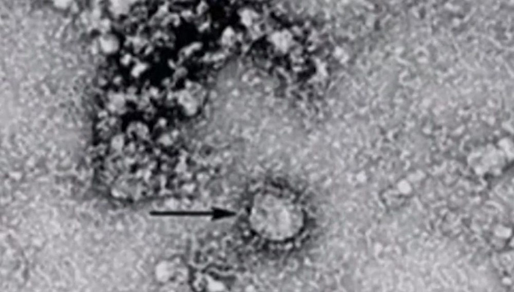 Пирола вирус. Серая фотография микроскопа. РАНДЕКС вирус.