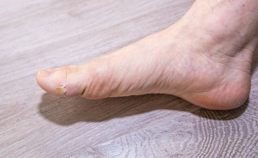 Vücut Sağlığı Kontrolü: 5 Dakikalık Testle Kendinizi Değerlendirin 77 9kXtkZA2XU27uGcEihhtYg