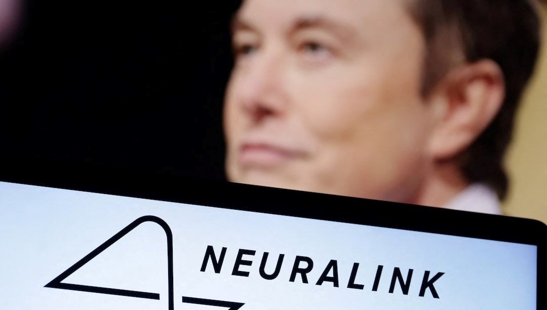 Neuralink'ten tarihi adım: Beyin çipiyle robotik kollar kontrol edilecek!