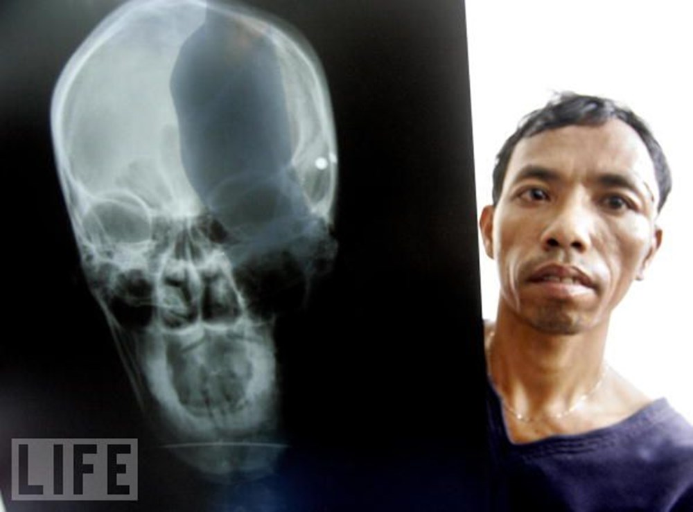 Hayatın röntgeni NTV Hayatın röntgeni NTV