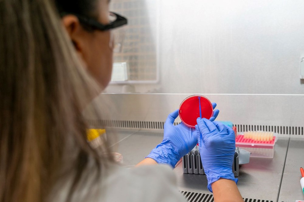 151 kişinin vefatına neden olan salgın tasa yarattı: Yetkililer 3 belirtiye karşı uyarıyor 72