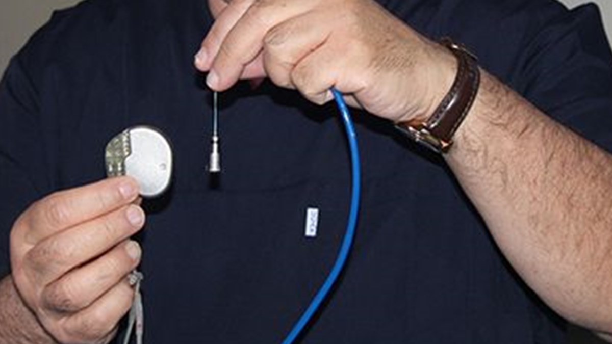 Kalp Pili 2 Grama Dustu Kabloya Da Ihtiyac Yok Saglik Haberleri Ntv