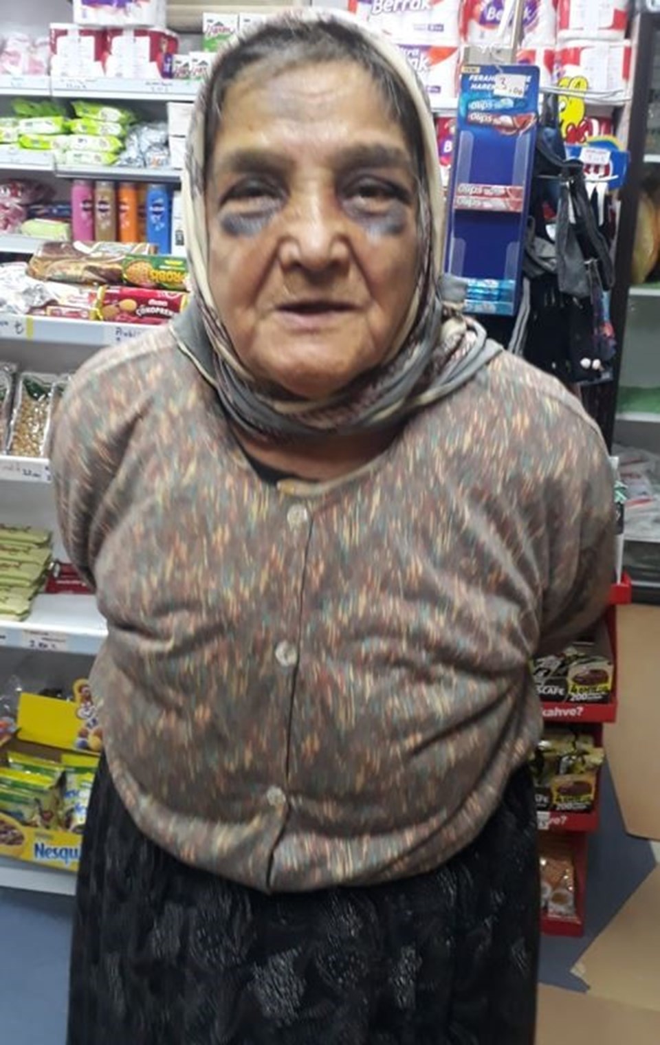 Kocaeli'de eşinin dövdüğü 73 yaşındaki kadın, konukevine yerleştirildi - 1