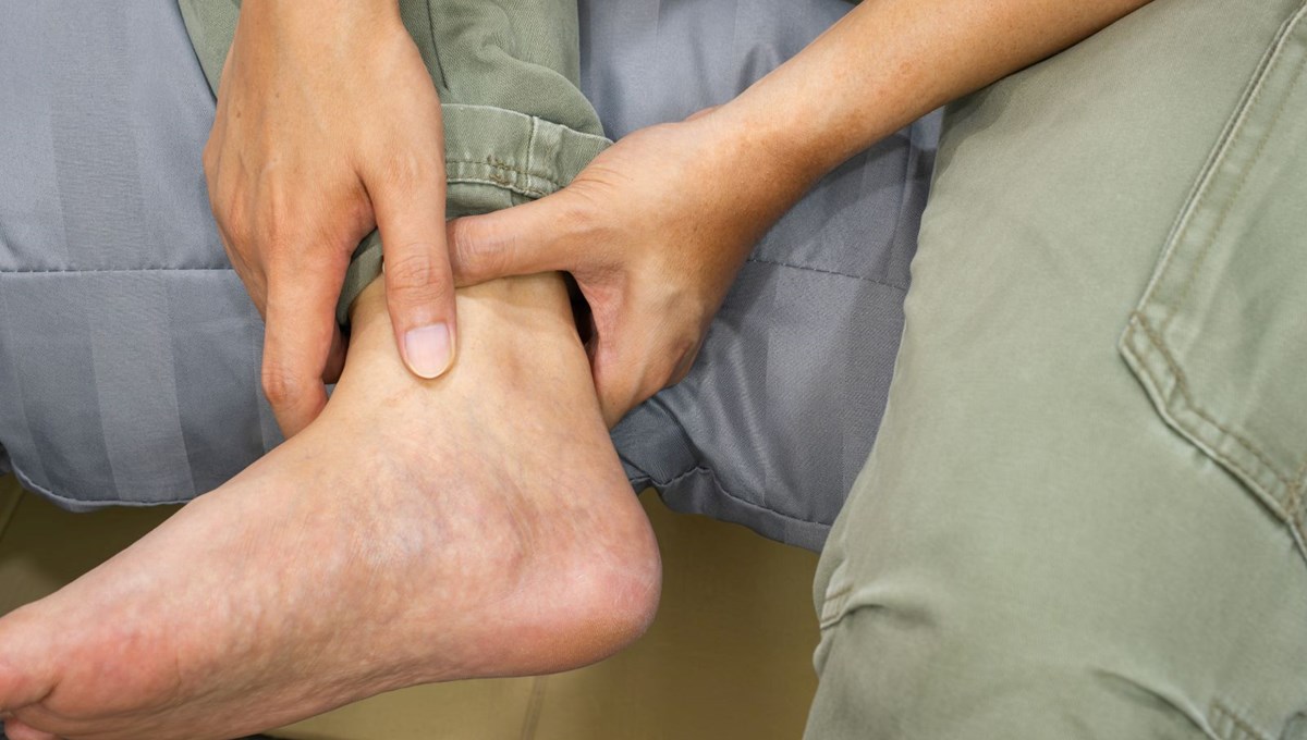 Akciğer kanserinin belirtisi: Bacak ve ayaklarda ortaya çıkıyor Akciğer kanserinin belirtisi: Bacak ve ayaklarda ortaya çıkıyor