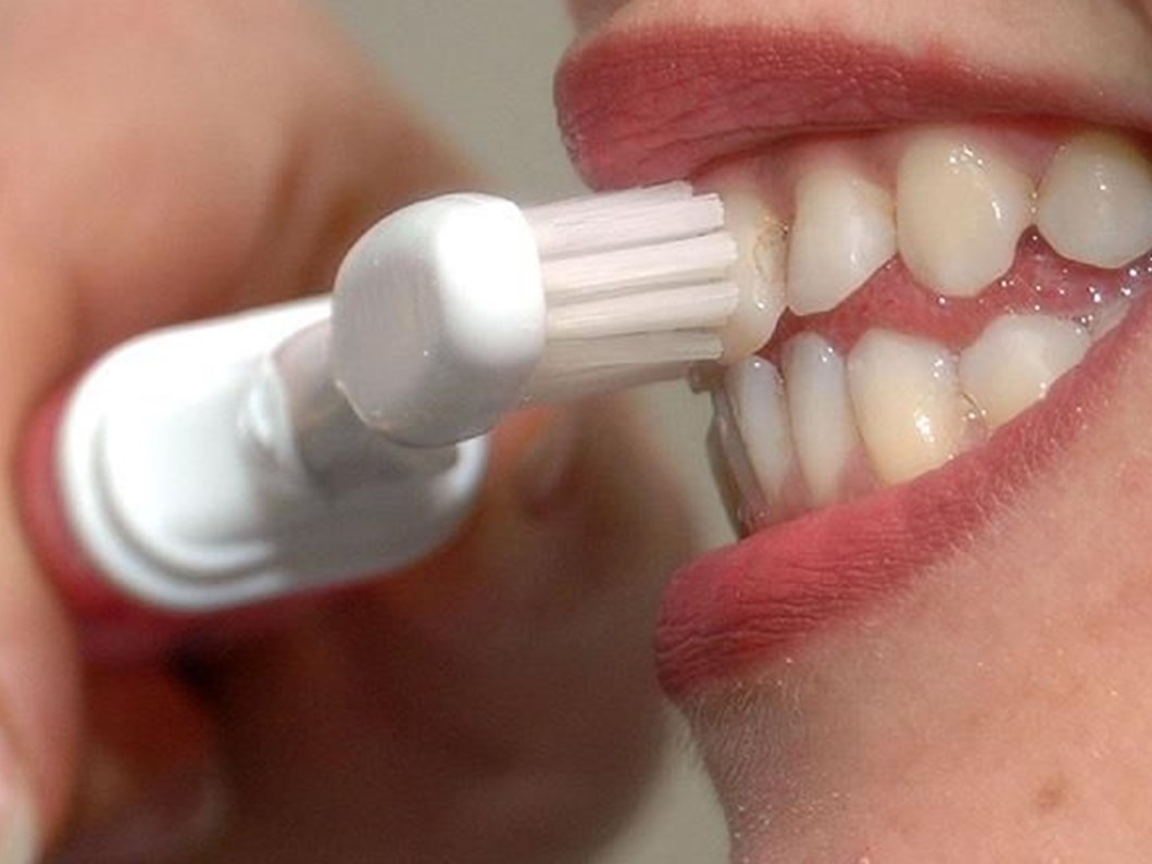 dislerinizi fircaladiktan sonra