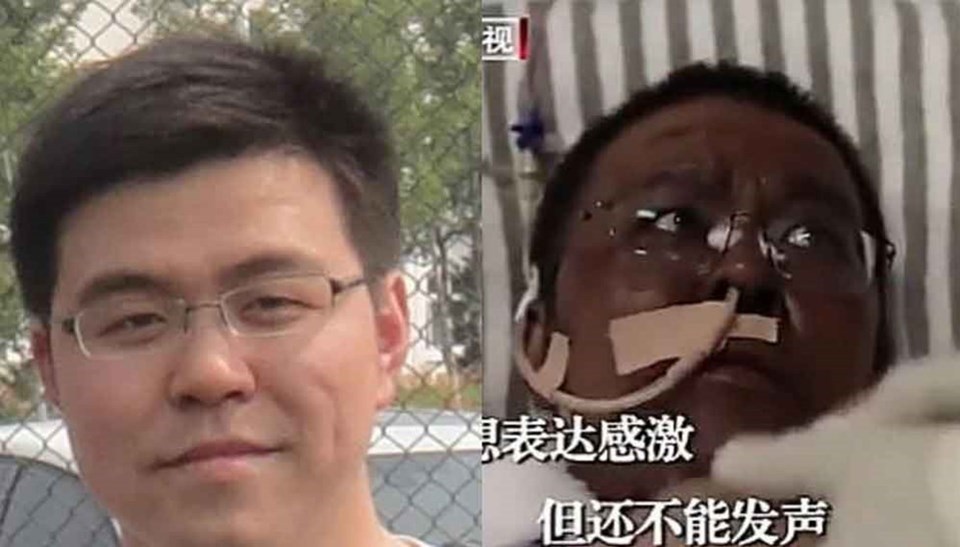Corona virüs tedavisinde ten rengi değiştikten bir kaç ay sonra hayatını kaybeden Ürolog Hu Weifeng