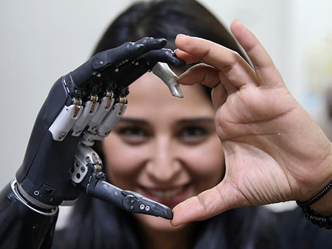 biyonik protez kol fiyatlari