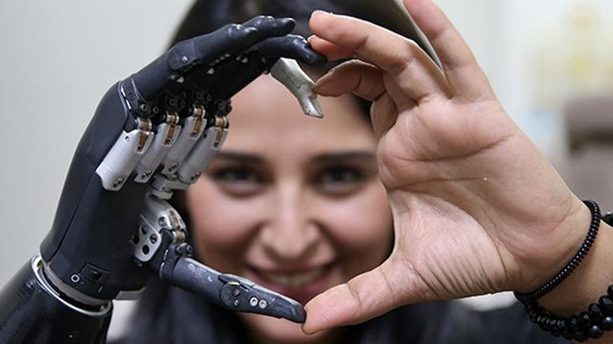 Biyonik Kol Revo Yla Hayata Tutunuyor Saglik Haberleri Ntv Biyonik Kol Revo Yla Hayata Tutunuyor Saglik Haberleri Ntv