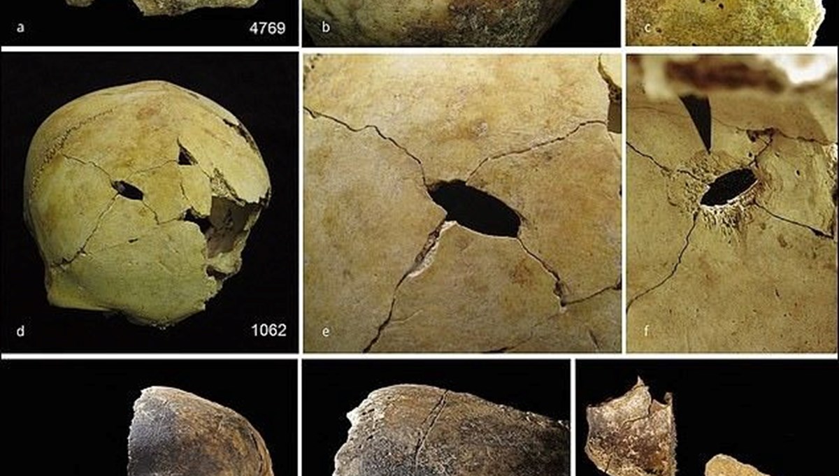 Bronz Çağı’nda Britanya: 4 bin 500 yıllık yamyamlık ve toplu katliamın izleri ortaya çıktı! Bronz Çağı’nda Britanya: 4 bin 500 yıllık yamyamlık ve toplu katliamın izleri ortaya çıktı!