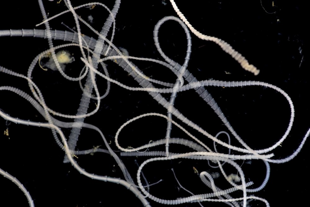 Doktorları şaşırtan görüntü: Tenyalar organlarını delik deşik etti - 6