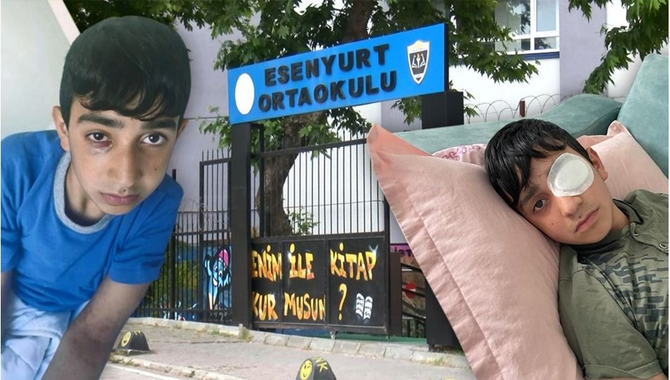 Okulda görme kaybı yaşatan dayak