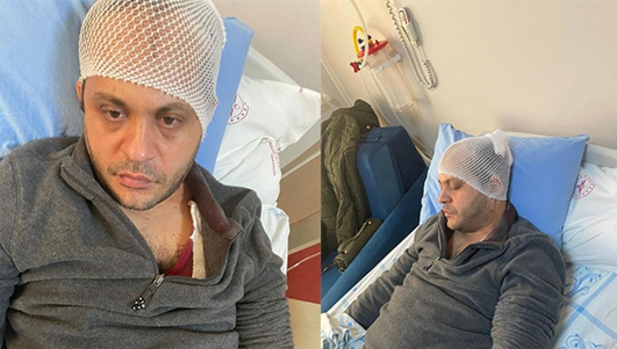 Gaziantep'te hasta yakınından doktora mermerli saldırı