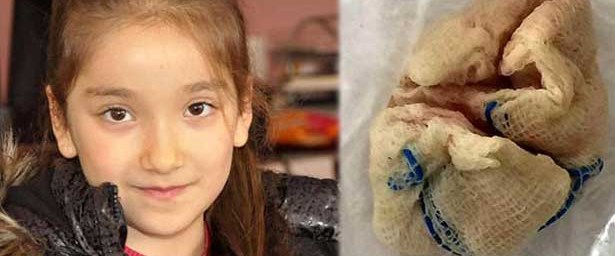 Bademcik ameliyatı oldu, boğazında gazlı bez unutuldu Sağlık