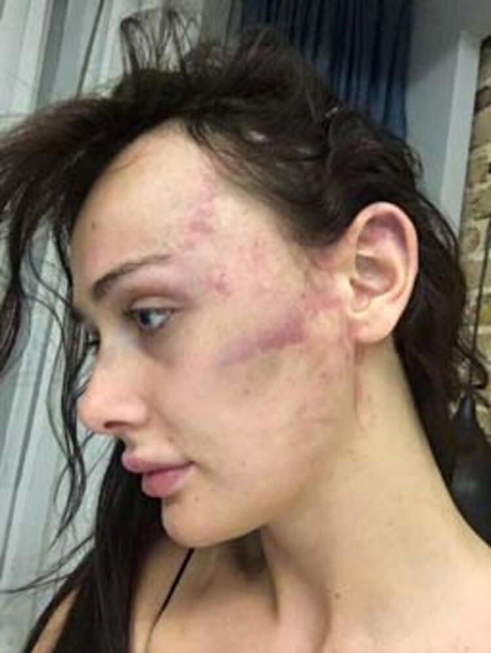 Sevgilisi Sırp model Tanja Dukiç'i dövdüğü iddia edilen yönetmen Çağrı Reşat Mehmet Tortop'un yaralama davasında karar - 6