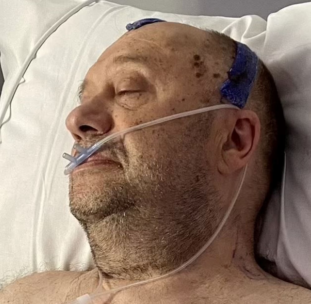 Yıllardır depresyonda olduğunu sanıyordu: Beyninde 7 santimetrelik tümör bulundu - 1