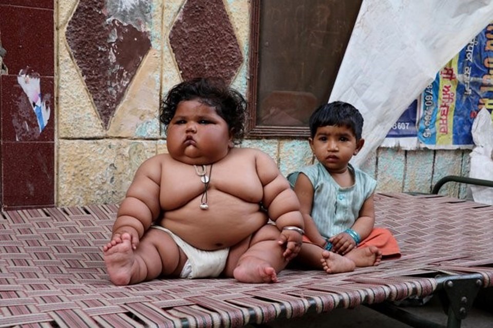 Görenler şaşırıyor, 8 aylık Chahat Kumar bebek 17 kilo! - 2