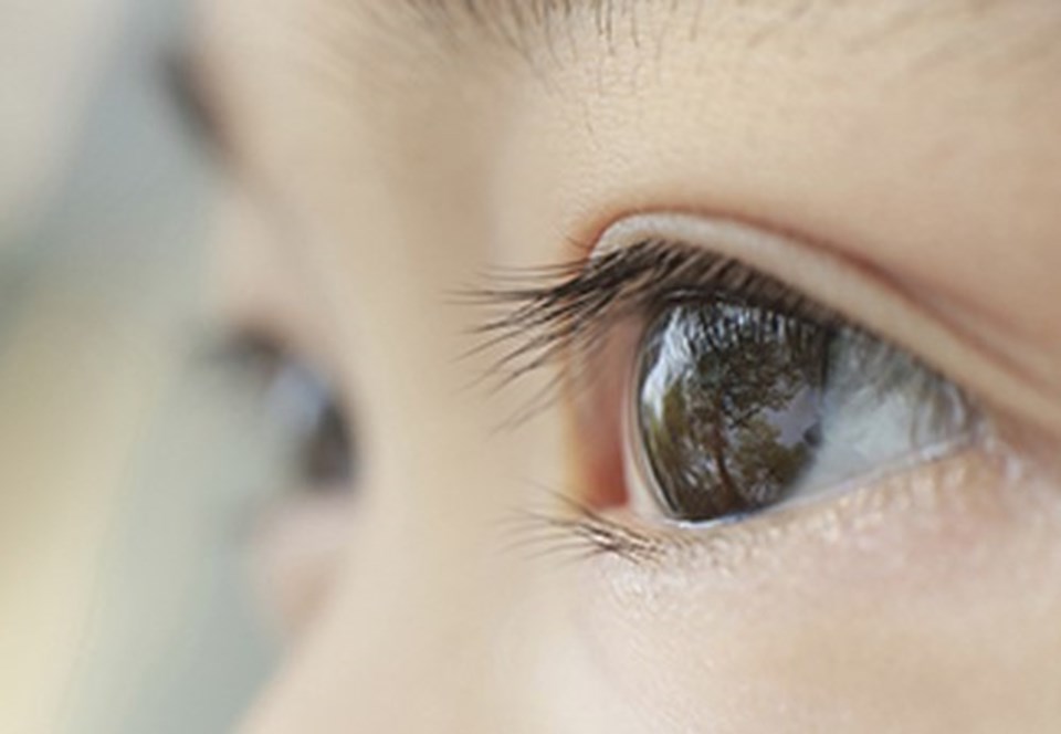 Göz protezinde bilinmesi gereken 8 şey - 1