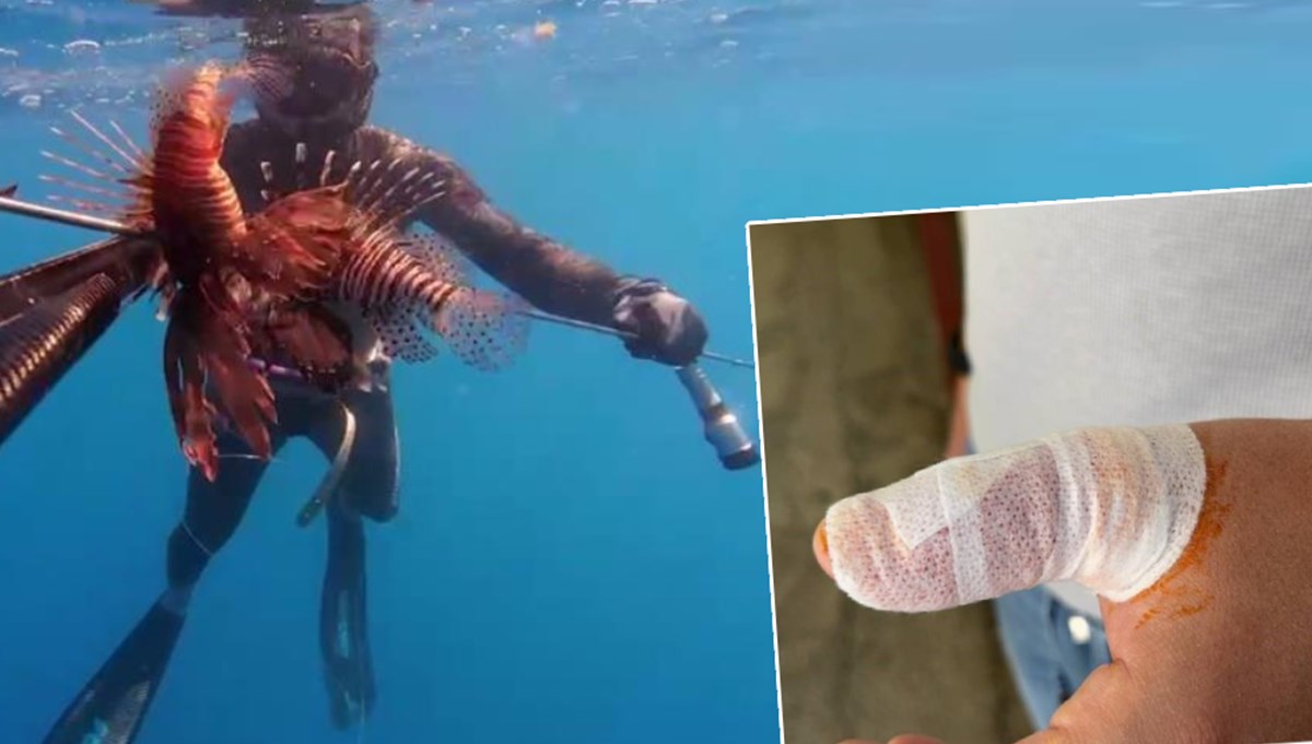 Ölü zannedip dokundu, parmağı bir anda şişmeye başladı: “Ağzındaki dikenler elime saplandı, çok değişik bir acı hissettim” Ölü zannedip dokundu, parmağı bir anda şişmeye başladı: “Ağzındaki dikenler elime saplandı, çok değişik bir acı hissettim”