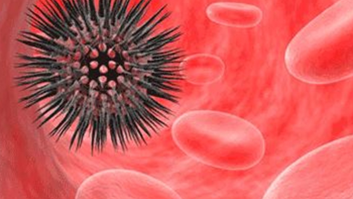 lenfoma tedavisi dogru taniyla