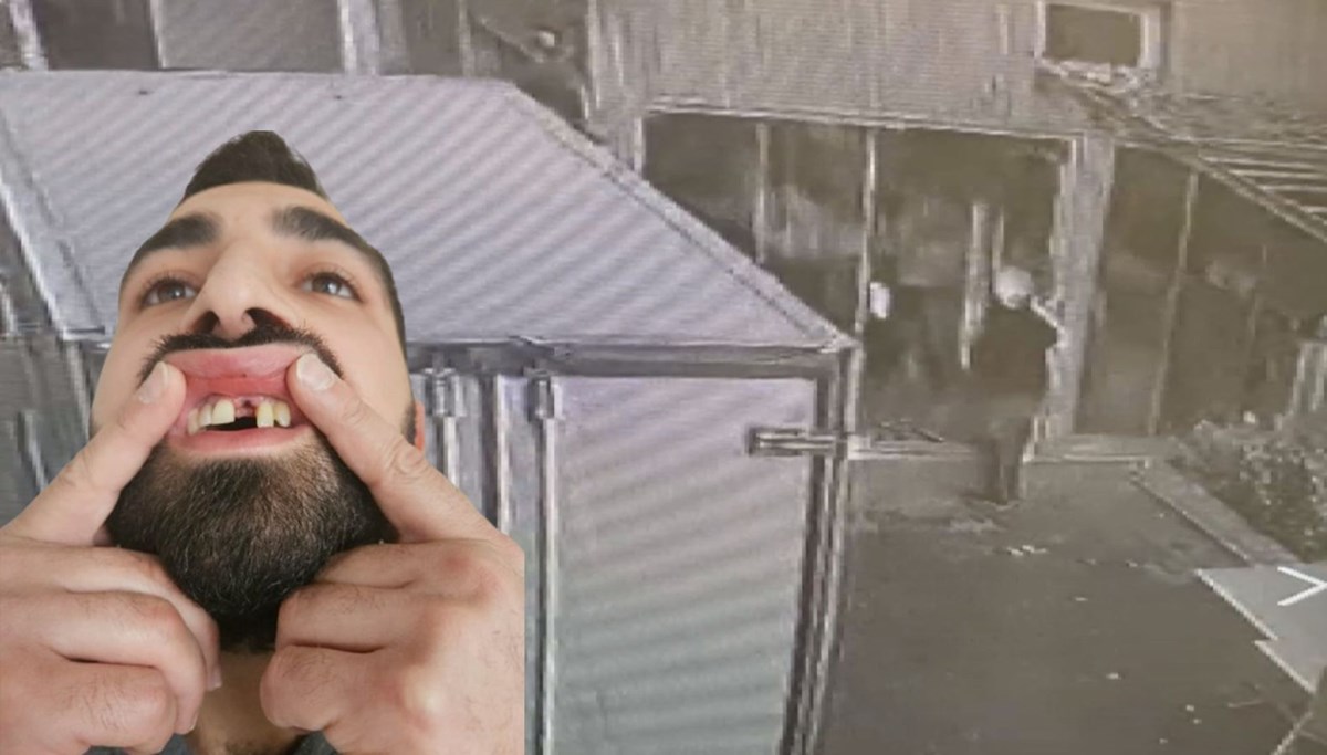 Pilavcıda kapıyı açık unuttu, öldüresiye dayak yedi: Dişleri döküldü Pilavcıda kapıyı açık unuttu, öldüresiye dayak yedi: Dişleri döküldü