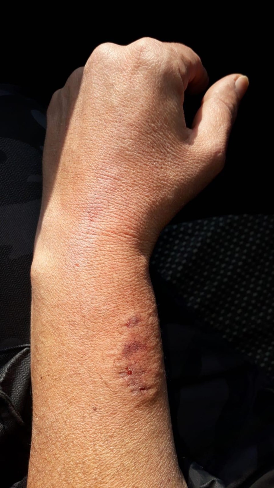 HDP'li milletvekili, polisin kolunu ısırdı - 1
