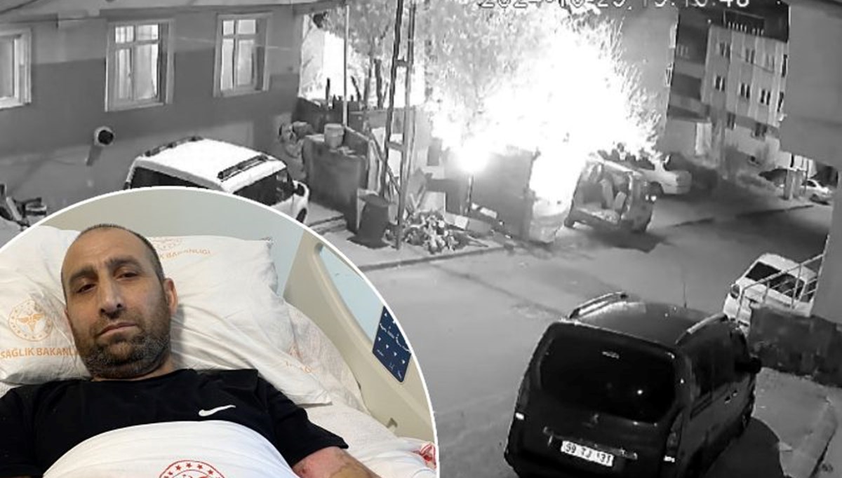 Mangal yaparken kendini yaktı! Vücudunun yüzde 80'i yandı Mangal yaparken kendini yaktı! Vücudunun yüzde 80'i yandı