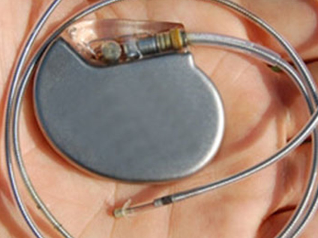 Kalp Pili Hayat Kurtariyor Saglik Haberleri Ntv