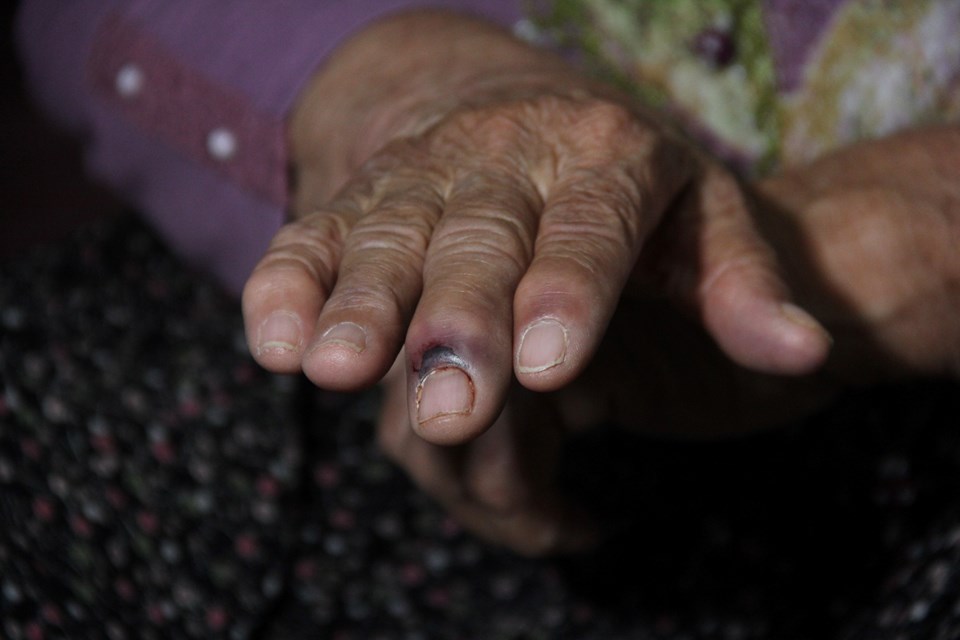 Adana'da 80 yaşındaki kadın evinde saldırıya uğradı - 2