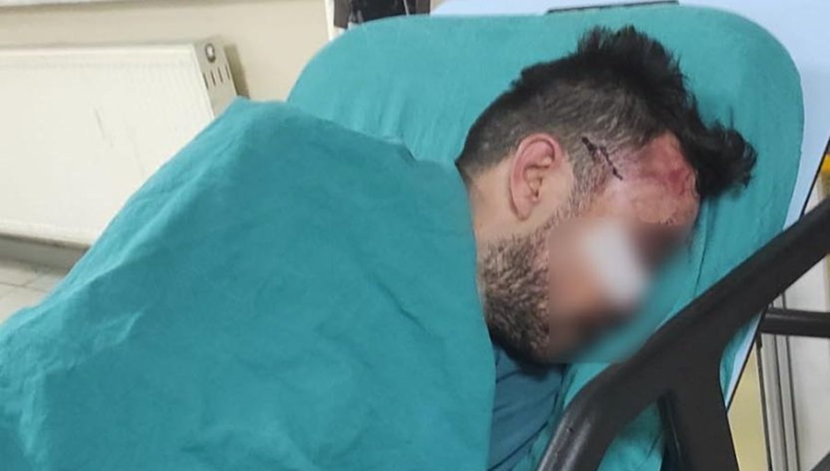 Üniversiteliye taciz girişimine tekme tokat dayak