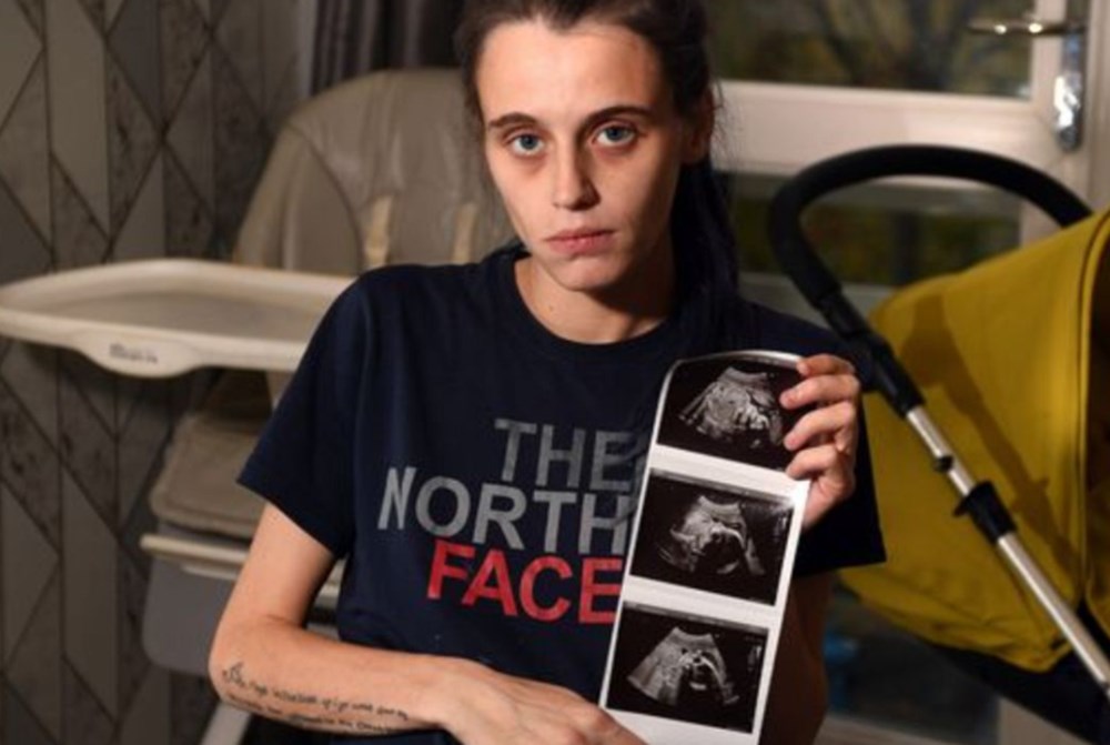 Annelik içgüdüsü kurtardı: Doktorların 'ölü' dediği bebeği canlı doğurdu - 1