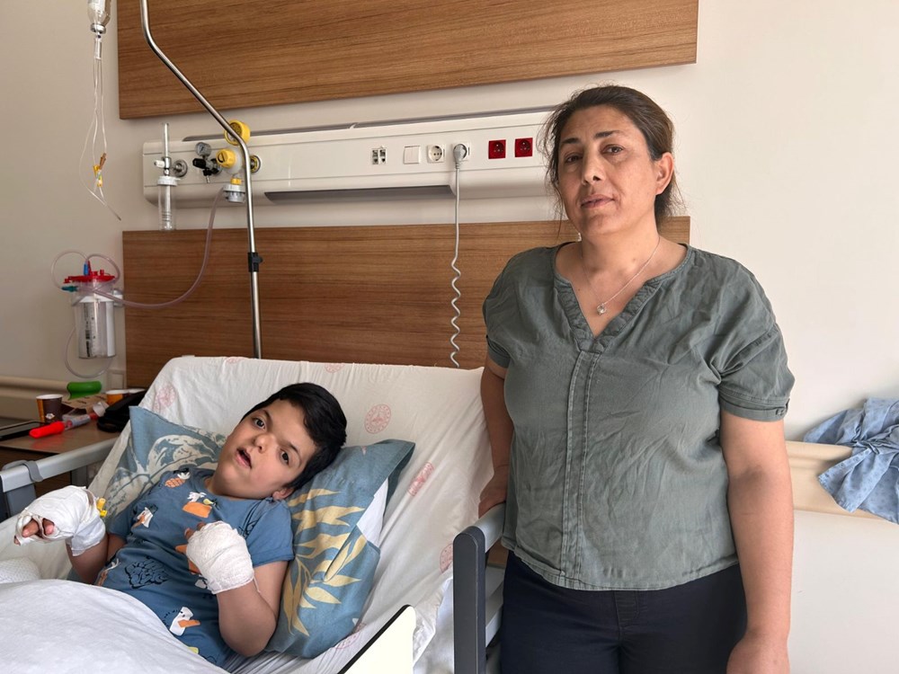 Doktorların bile ismini yeni duyduğu hastalık: 4 yaşındaki Umut'ın 10 parmağı açıldı - 3