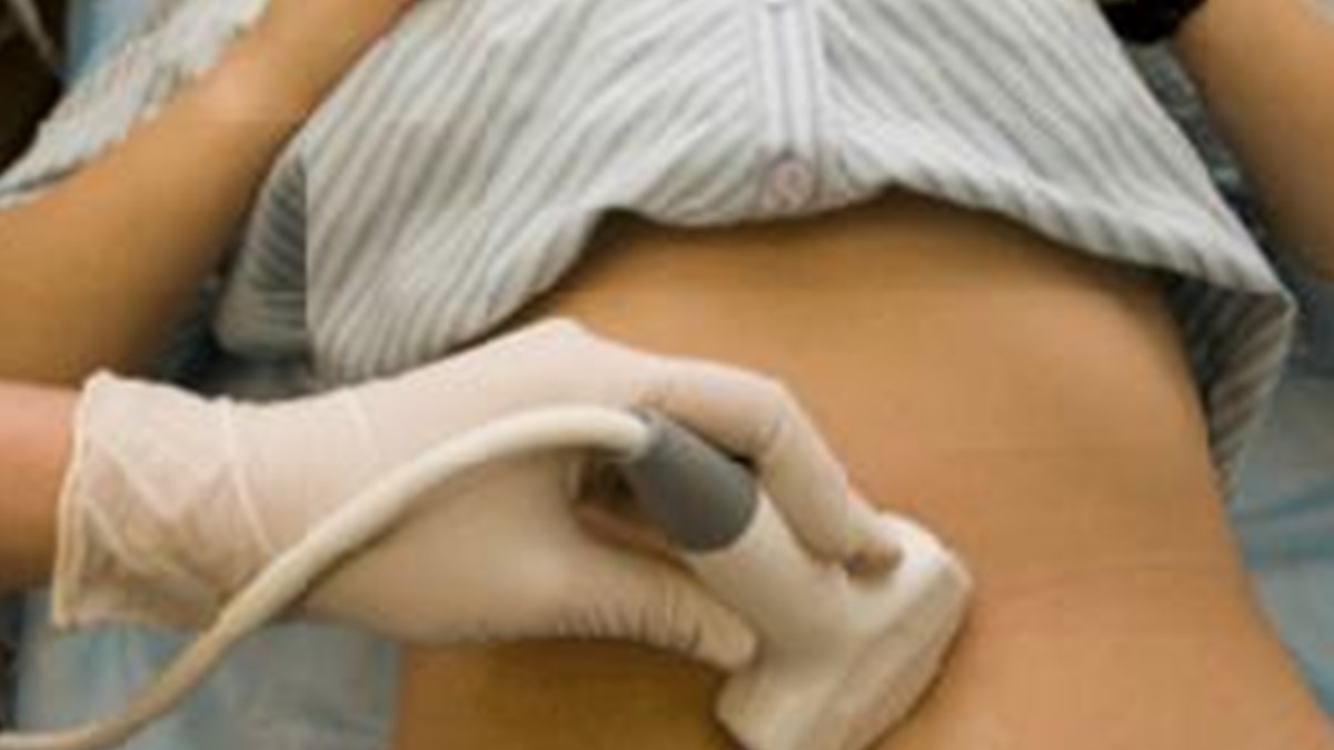 Miyoma Ses Tedavisi Saglik Haberleri Ntv