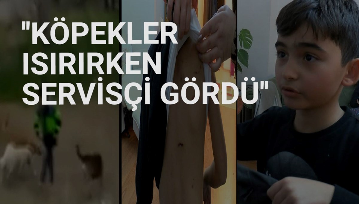 Okula giden çocuğa sokak köpekleri saldırdı Okula giden çocuğa sokak köpekleri saldırdı