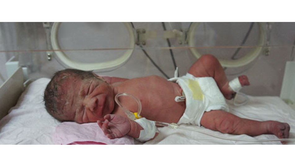 Anne karnındaki bebeğe hayat veren 3 dakika Sağlık Anne karnındaki bebeğe hayat veren 3 dakika Sağlık