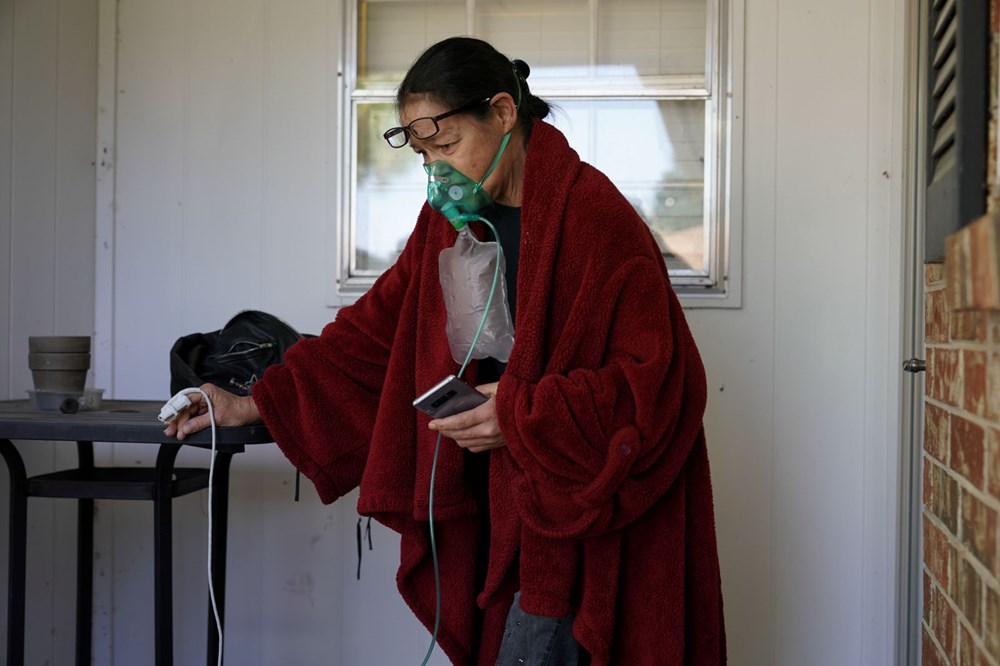 Covid-19 belirtileri yine değişti: 5 semptoma dikkat (Corona virüs semptomları) - 9