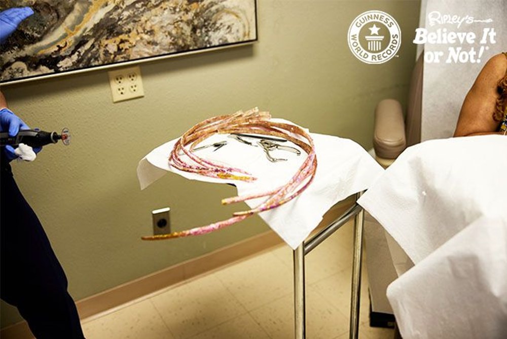 7 meters 33 centimeters: The person with the longest nails in the world cut their nails after 30 years - 10