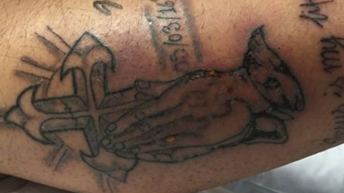 Dovme Yaptirdiktan 5 Gun Sonra Hayatini Kaybetti Dovme Yaptirirken Dikkat Saglik Haberleri Ntv