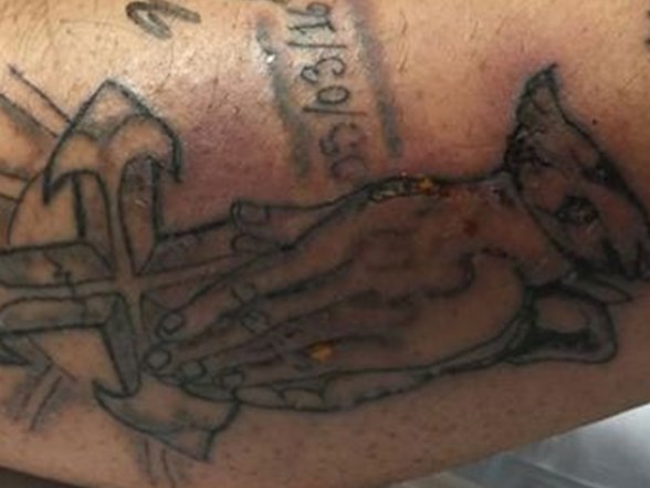 Dovme Yaptirdiktan 5 Gun Sonra Hayatini Kaybetti Dovme Yaptirirken Dikkat Saglik Haberleri Ntv