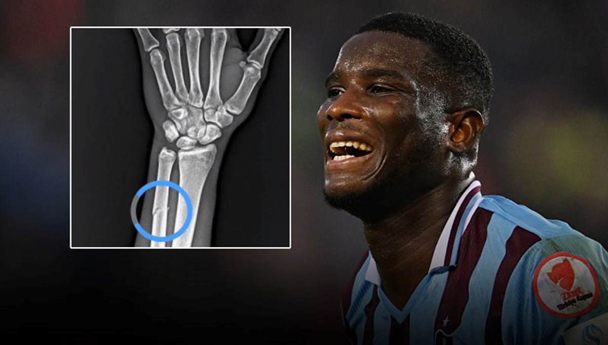 Trabzonspor'dan Onuachu tepkisi: Röntgen görüntüsü paylaşıldı