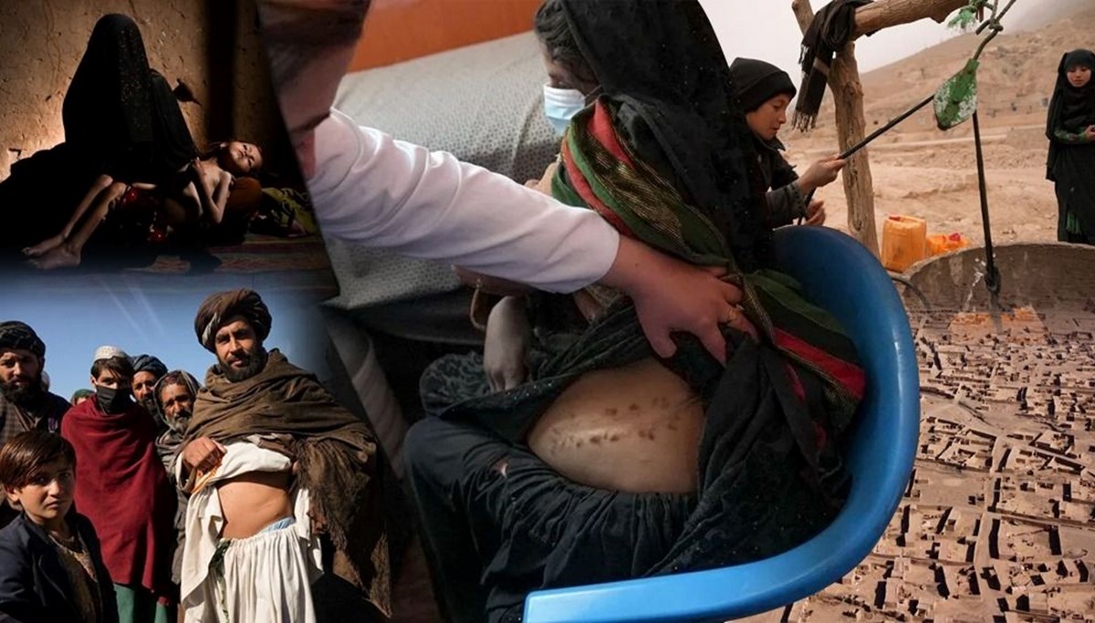 Afganistan'ın organ pazarı haline gelen kenar mahalleleri: 6 ve 8 yaşındaki iki kızımın ardından böbreğimi sattım Afganistan'ın organ pazarı haline gelen kenar mahalleleri: 6 ve 8 yaşındaki iki kızımın ardından böbreğimi sattım