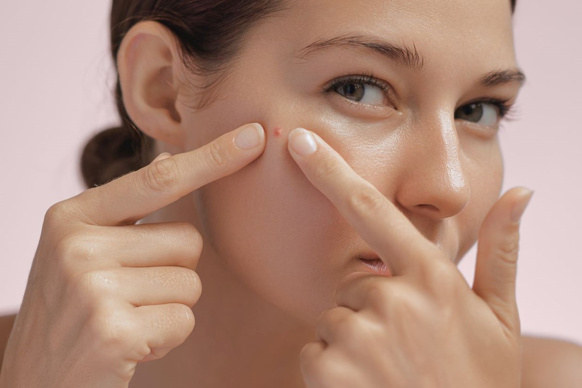 Dermatolog açıkladı: Basit bir sivilce kanserin işareti olabilir