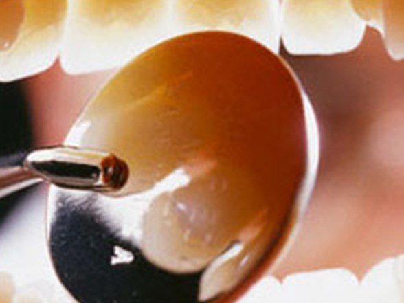 Kalp Krizi Sinyali Agizda Basliyor Saglik Haberleri Ntv