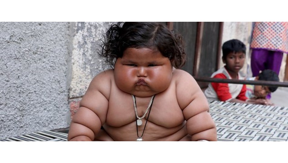 Görenler şaşırıyor, 8 aylık Chahat Kumar bebek 17 kilo Görenler şaşırıyor, 8 aylık Chahat Kumar bebek 17 kilo