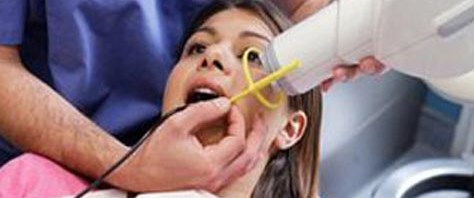 Diş röntgeni beyin tümörü riskini artırıyor Sağlık Haberleri NTV