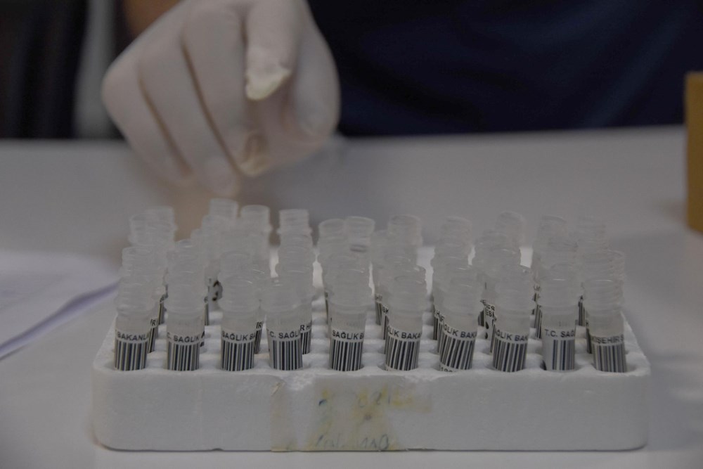 Mutated corona virus cases are detected in 40 minutes - 6