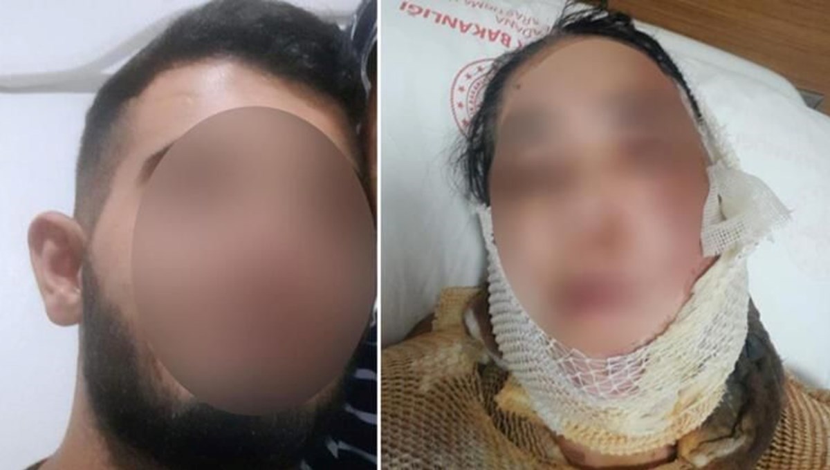 Adana'da üvey anneye kezzaplı saldırı Adana'da üvey anneye kezzaplı saldırı