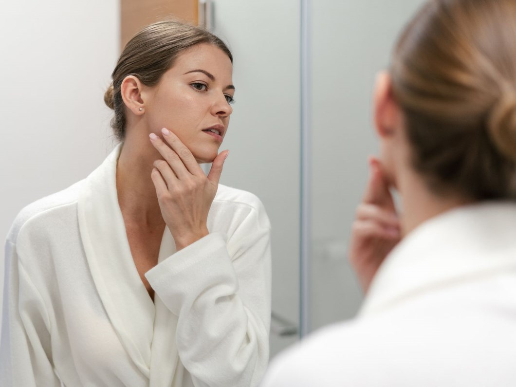 Gul Hastaligi Rozasea Nedir Gul Hastaligi Belirtileri Nelerdir Nasil Tedavi Edilir Saglik Haberleri Ntv