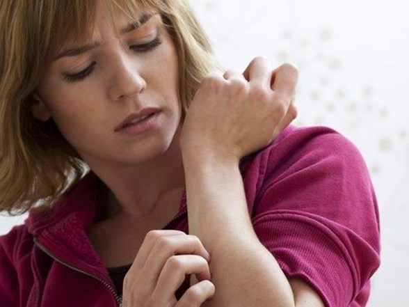 atopik dermatit egzama nedir egzama