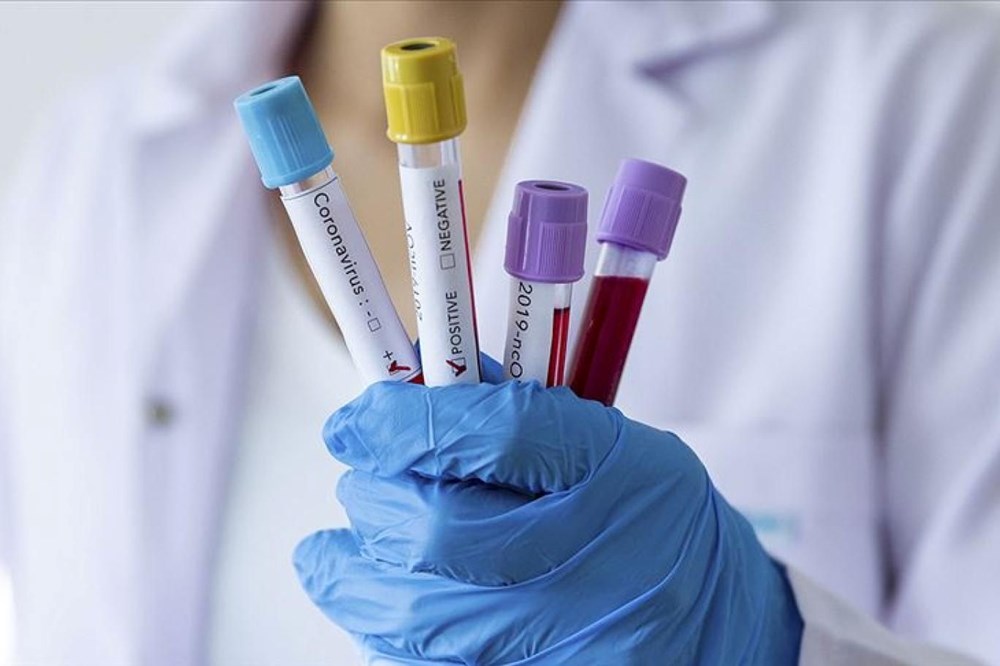 Covid-19 laboratuvarda mı üretildi? ABD istihbaratı ikiye bölündü - 4