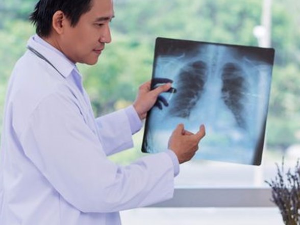 zaturrenin 7 belirtisine dikkat